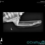Grace Wrist X-Ray #3 where Doc tried to fix it before amputating