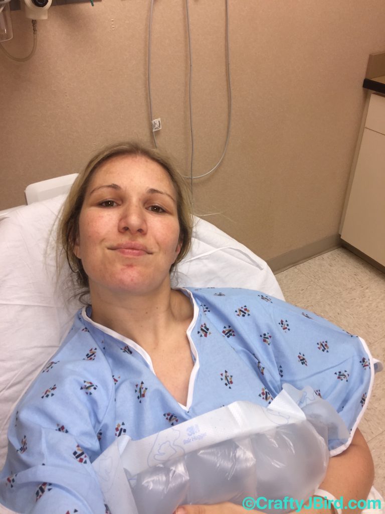 Hip Scope Surgery Part 2 -- Visit CraftyJBird.com for more info... 