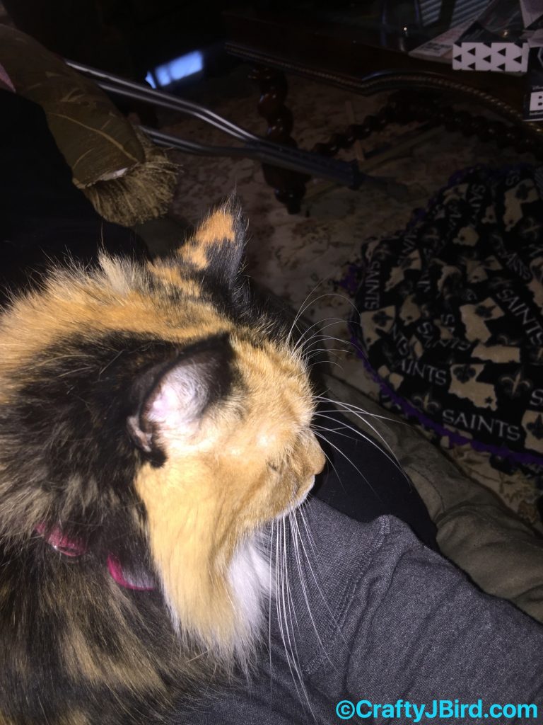 Hip Scope Surgery Part 2 -- Visit CraftyJBird.com for more info...