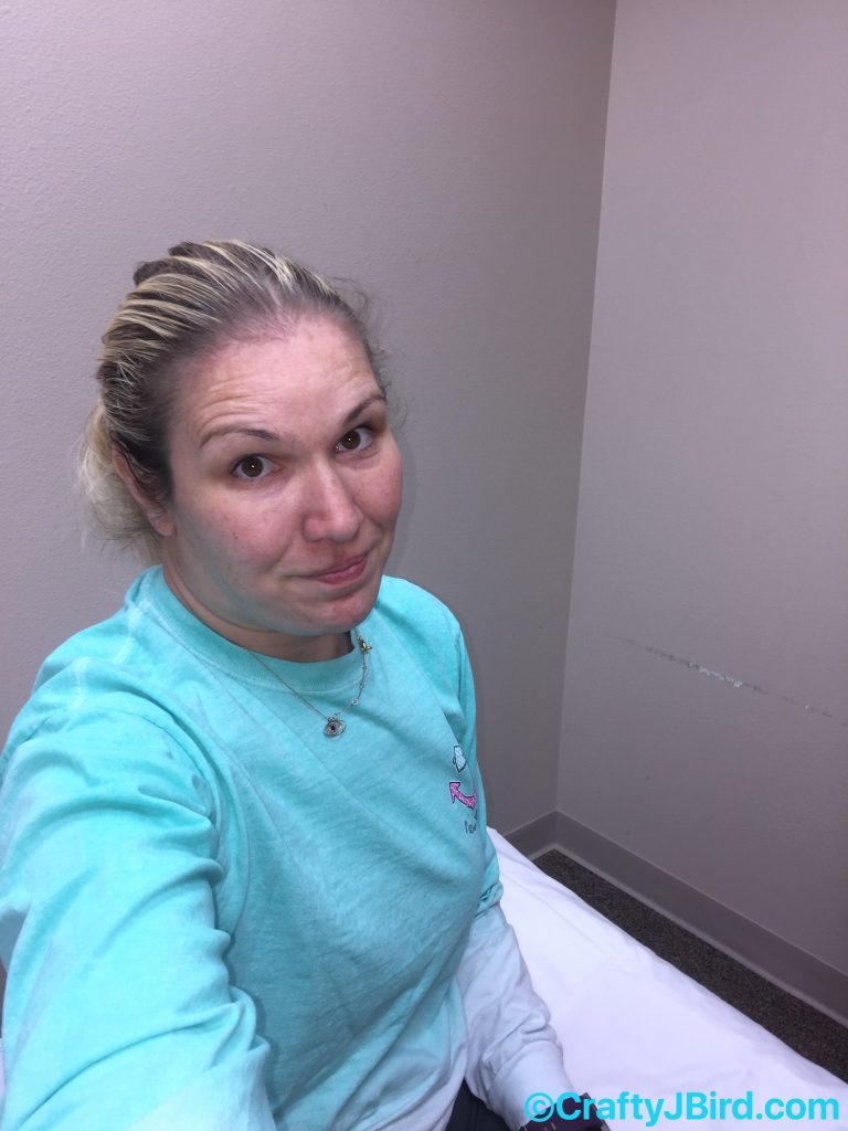 Hip Scope Surgery Part 2 -- Visit CraftyJBird.com for more info...